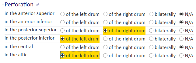 The Grid user input lets you select different values for each row.